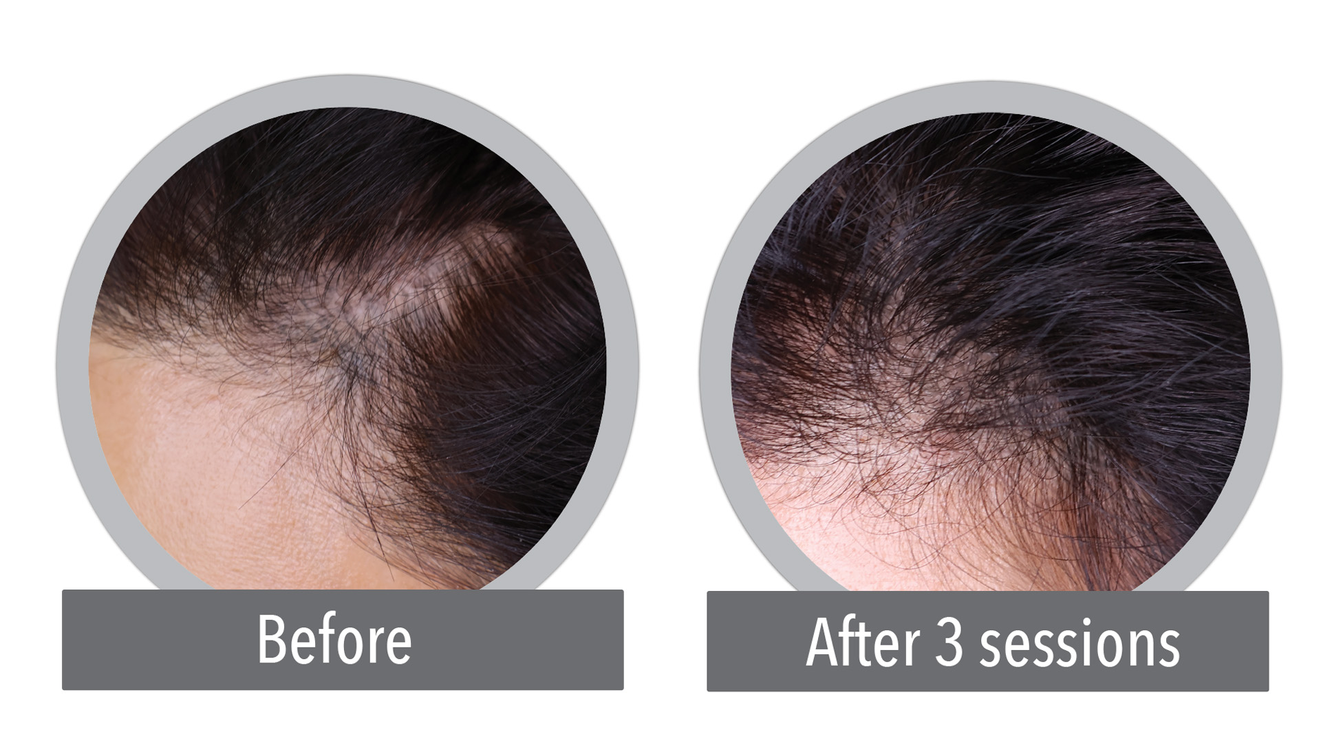 Hair Follicle Diagram